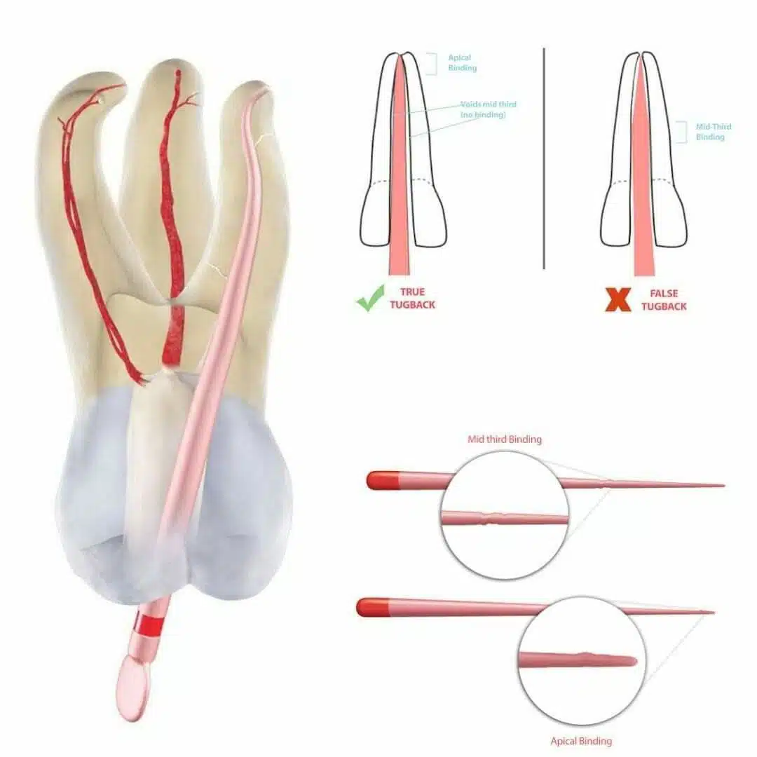 Endodontia