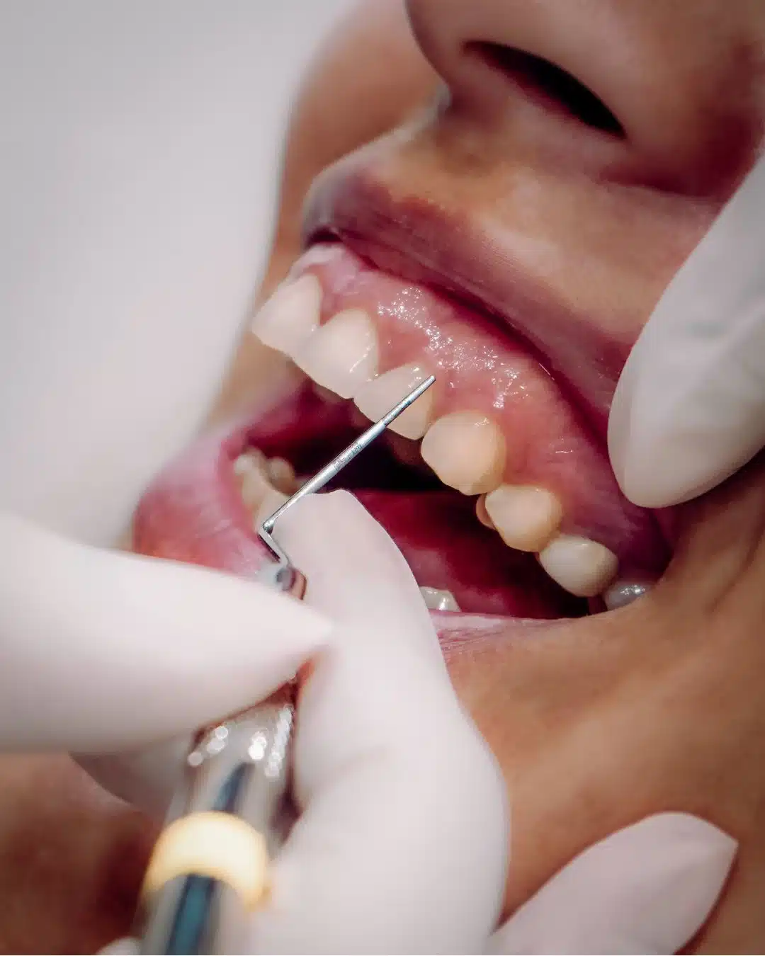 Periodontia